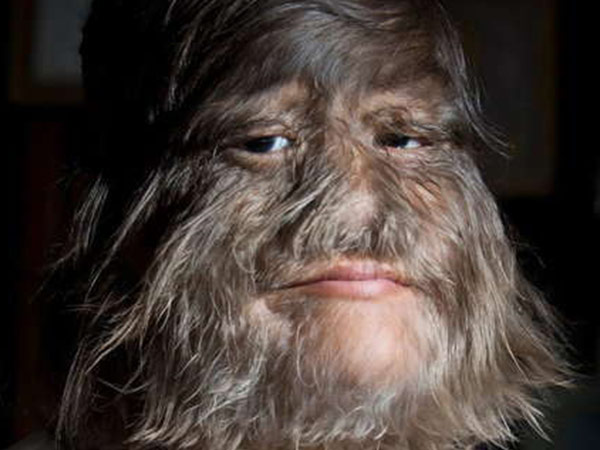 ఎక్కువగా బాధపడేది ఈమెనే