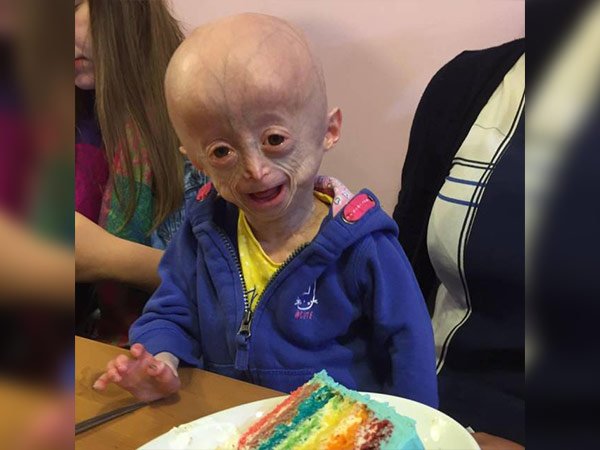 పుట్టిన‌ప్పుడు అంద‌రిలాగే