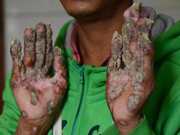 2016 మొదటి సారిగా 