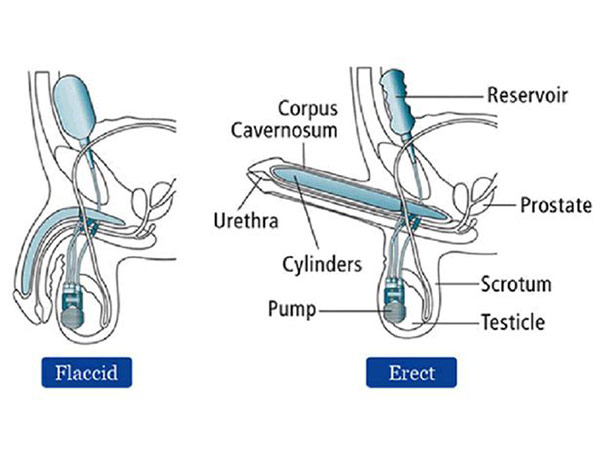 స్విచ్ నొక్కితే