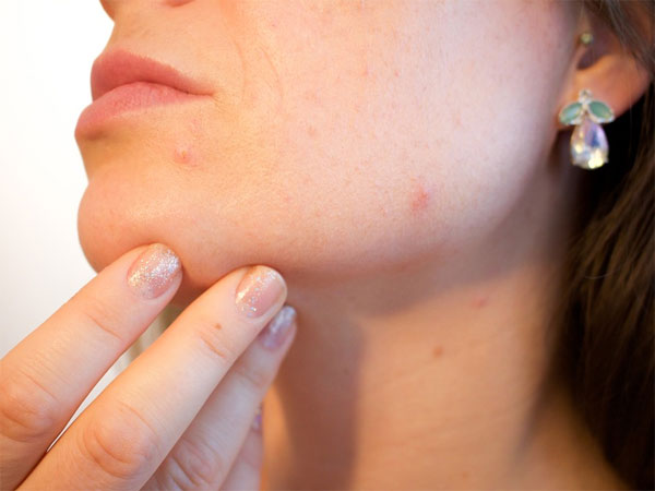 Say Goodbye To Pores Forever With These Simple Hacks Say Goodbye To Pores Forever With These Simple Hacks