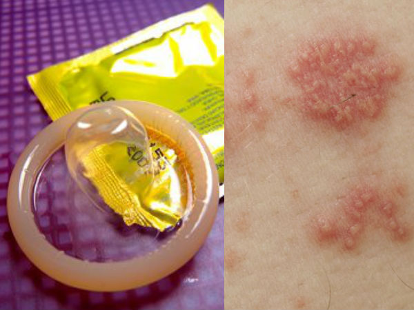 మీ అంగాన్ని బాగా కడుక్కోండి