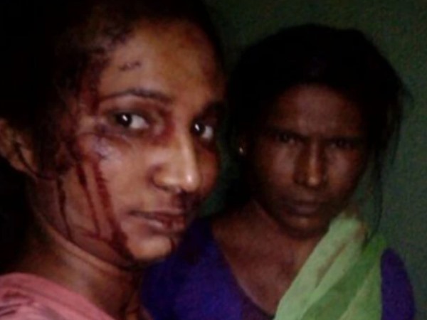 రక్తంతో ఎర్రబడిపోయింది