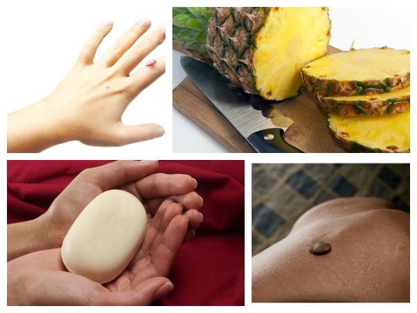 నొప్పి తక్కువగా ఉంటుంది.