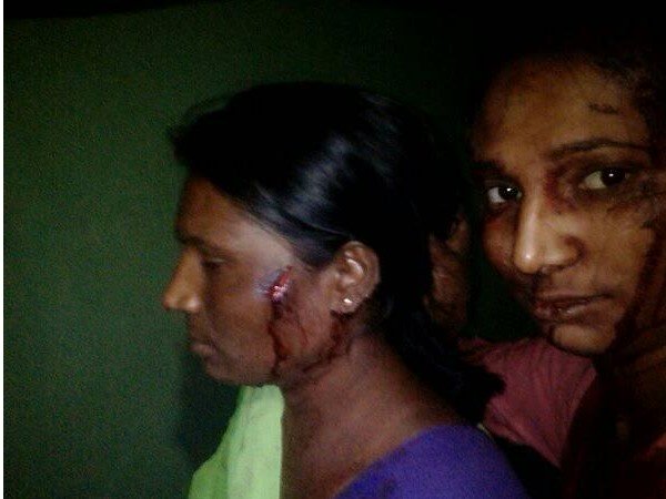 కర్ర తీసుకుని కొట్టింది