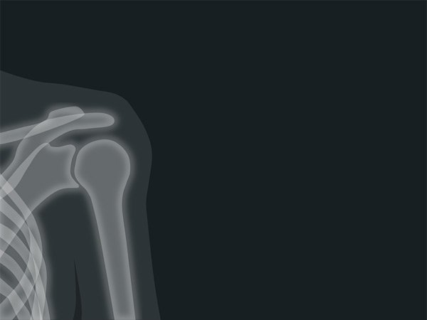 మరి నివారణ ఉందా లేదా ? 