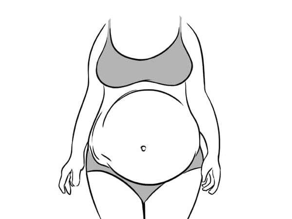 మీకు టైప్#5 రకం పొట్ట ఉంటే 