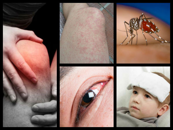 2. లక్షణాలు