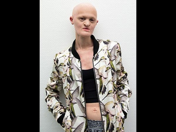 ఇలా బ్రతకడం అంత సులభమైన విషయమేమీ కాదు