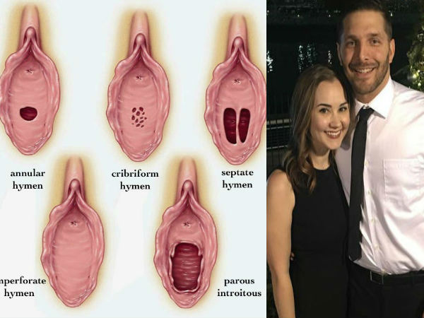 కన్నెపొరను తొలగించారు