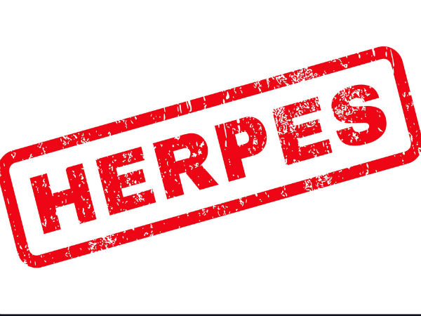 హెర్పెస్