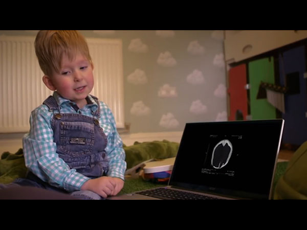 ఒకరోజు వైద్యులు సైతం ఆశ్చర్యపడేలా నోవాలో మార్పులు కనిపించాయి... ఒకరోజు వైద్యులు సైతం ఆశ్చర్యపడేలా నోవాలో మార్పులు కనిపించాయి...