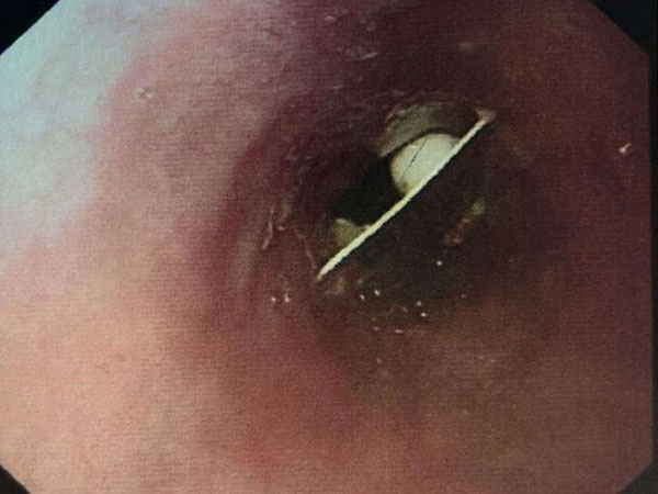 ఆమె సగం రాత్రిలో నిద్ర మత్తులో టాబ్లెట్ వేసుకోబోయింది …. 