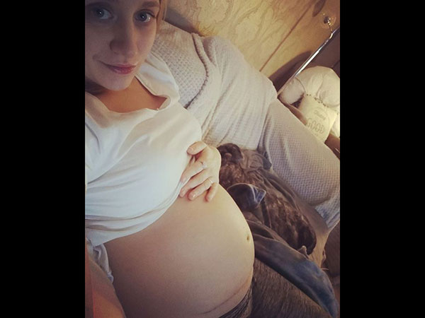 అసలేమిటీ స్పినా బిఫిడా ?