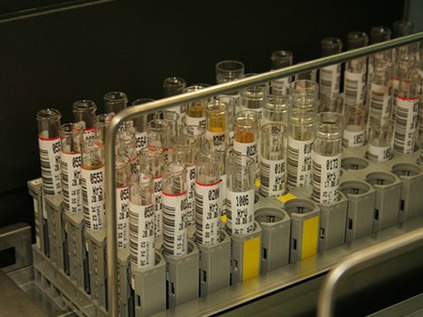 Goodpasture Syndrome