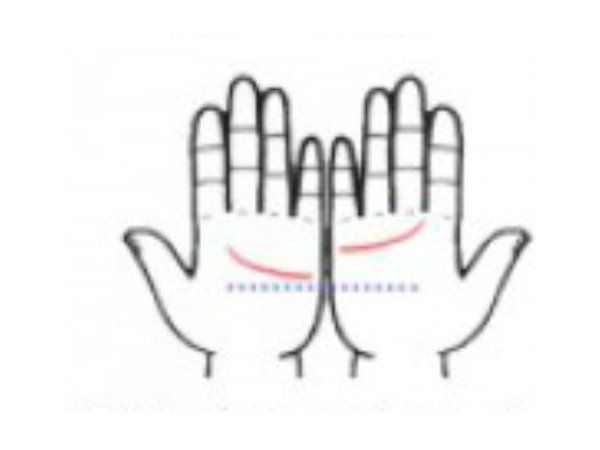 కుడి అరచేతి రేఖ ఎడమ అరచేతి రేఖ కంటే పైన ఉంటే కుడి అరచేతి రేఖ ఎడమ అరచేతి రేఖ కంటే పైన ఉంటే