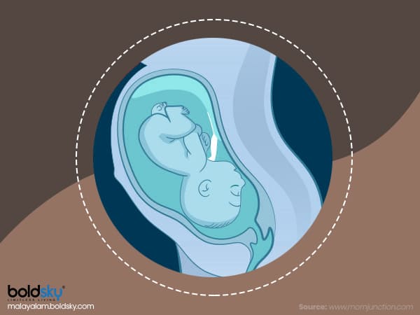 క్షితిజసమాంతర పరిస్థితి