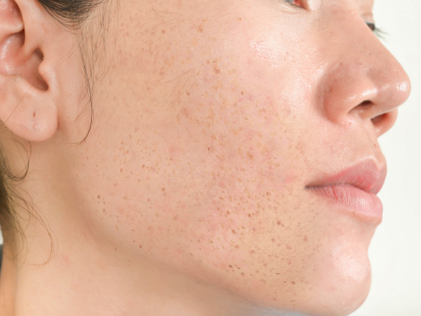 గంధం-పాలు మిక్స్