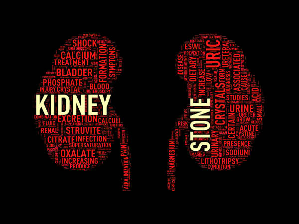 8. కిడ్నీ రాళ్లను ఎలా నివారించాలి: