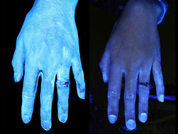  చేతులు చల్లగా మారడం