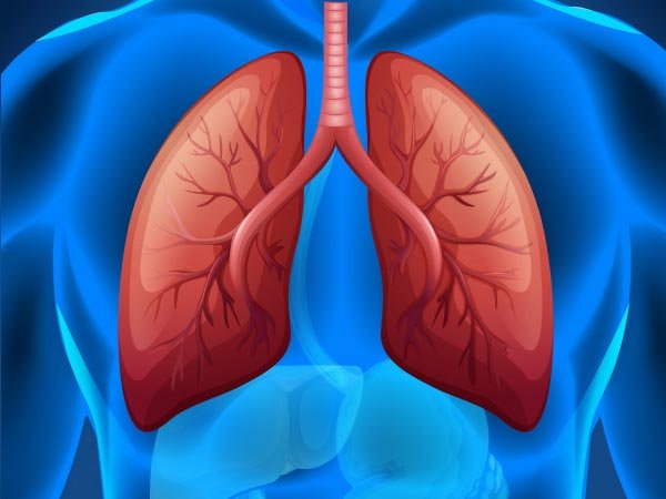 1. తీవ్రమైన శ్వాసకోశ బాధ సిండ్రోమ్