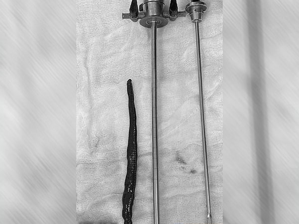 భరించలేని నొప్పి...