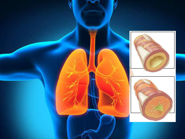 శ్లేష్మం బహిష్కరించడానికి