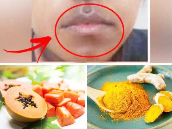 Ways to get rid of darkness around the mouth Ways to get rid of darkness around the mouth