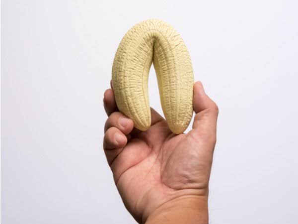 చర్మశోథ