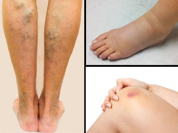 Ways Your Legs Can Show You if Something’s Wrong With Your Inner Organs Ways Your Legs Can Show You if Something’s Wrong With Your Inner Organs