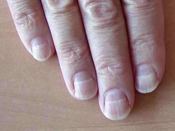  ఫలితాలు