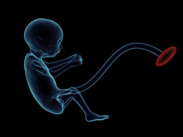  ప్లాసెంటా ప్రెవియా వచ్చే ప్రమాదం ఎవరికి ఉంది