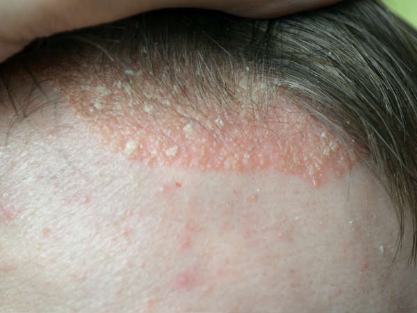 కండీషనర్ ఉపయోగించడం లేదు