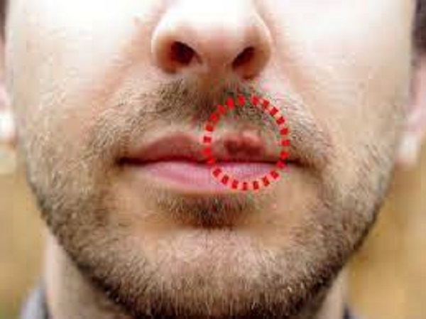 మౌఖిక పరీక్ష