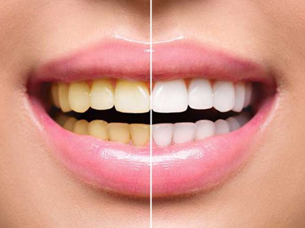 12. నోటి ఆరోగ్యం క్షీణించవచ్చు