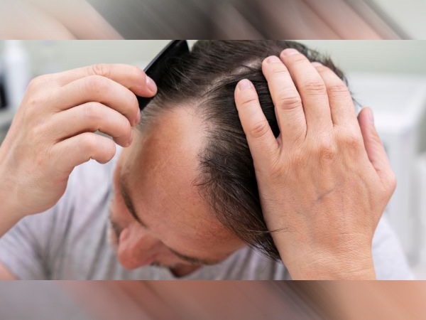 9. జుట్టు పలచబడుతుంది