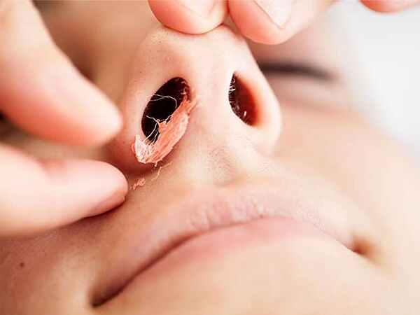 ముక్కు వెంట్రుకలను తొలగించడం వల్ల కలిగే ఆరోగ్య ప్రభావాలు ఏమిటి?