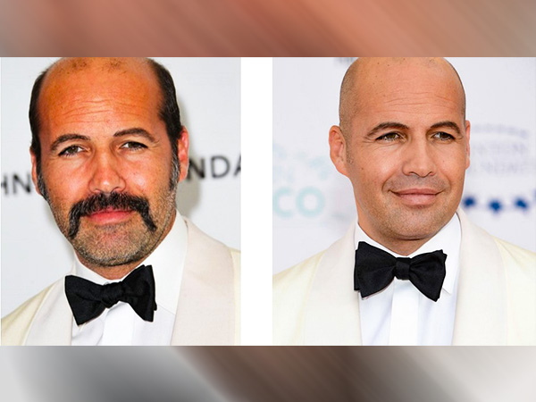 బట్టతలతో ఆకర్షణీయంగా ఎలా ఉండాలి?