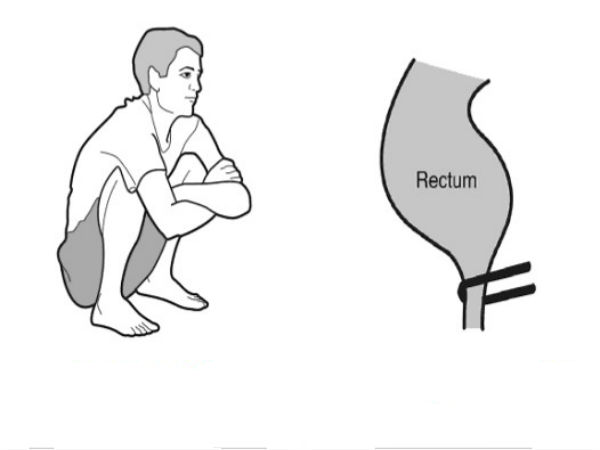 Using Indian style toilets during pregnancy benefits and safety measures in Telugu Using Indian style toilets during pregnancy benefits and safety measures in Telugu