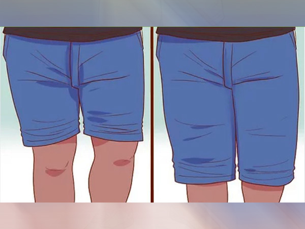5. షార్ట్‌లు మోకాళ్ల పైకి ఉండేలా చూసుకోండి