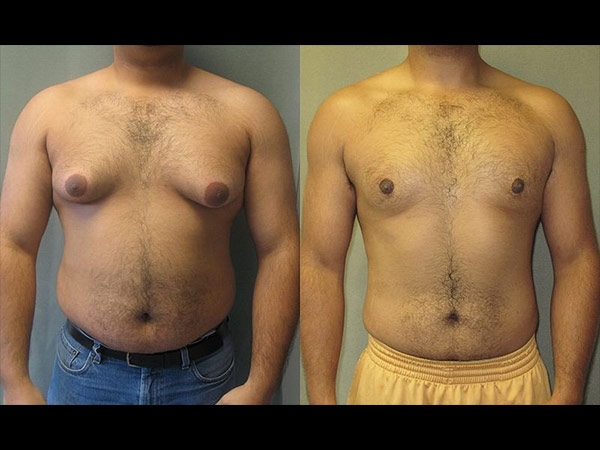 5. సోయా పురుషులను స్త్రీలుగా చేస్తుంది 5. సోయా పురుషులను స్త్రీలుగా చేస్తుంది