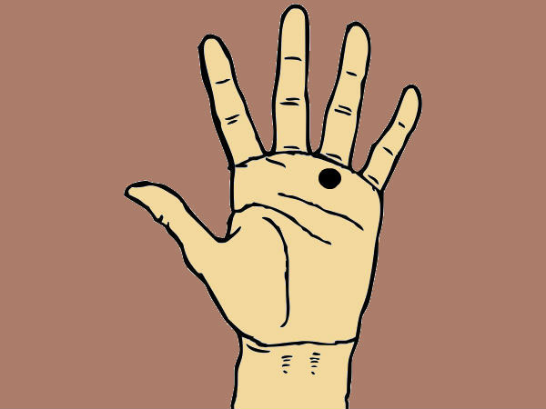 ఉంగరపు వేలుపై పుట్టుమచ్చ