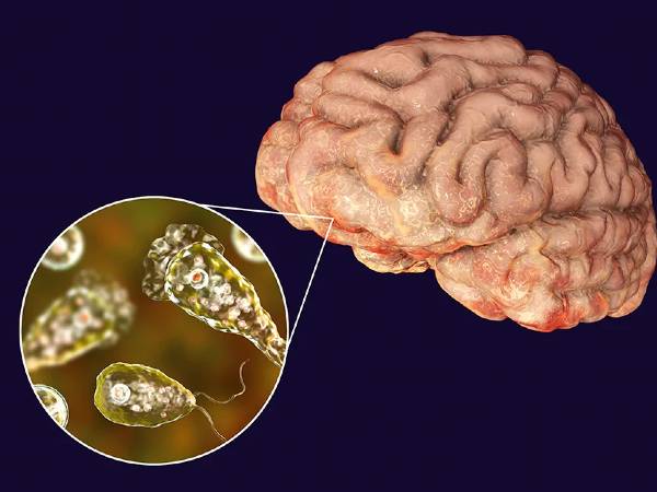 'మెదడును తినే అమీబా' ఎలా సోకుతుందంటే..