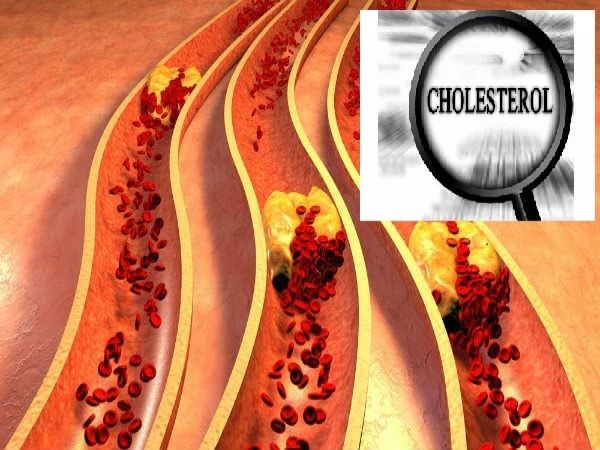 కొలెస్ట్రాల్‌ను నియంత్రిస్తుంది