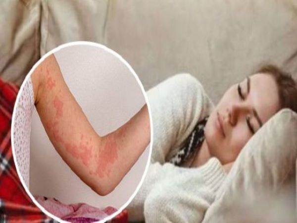 చర్మ సమస్యలు కూడా వస్తాయి: