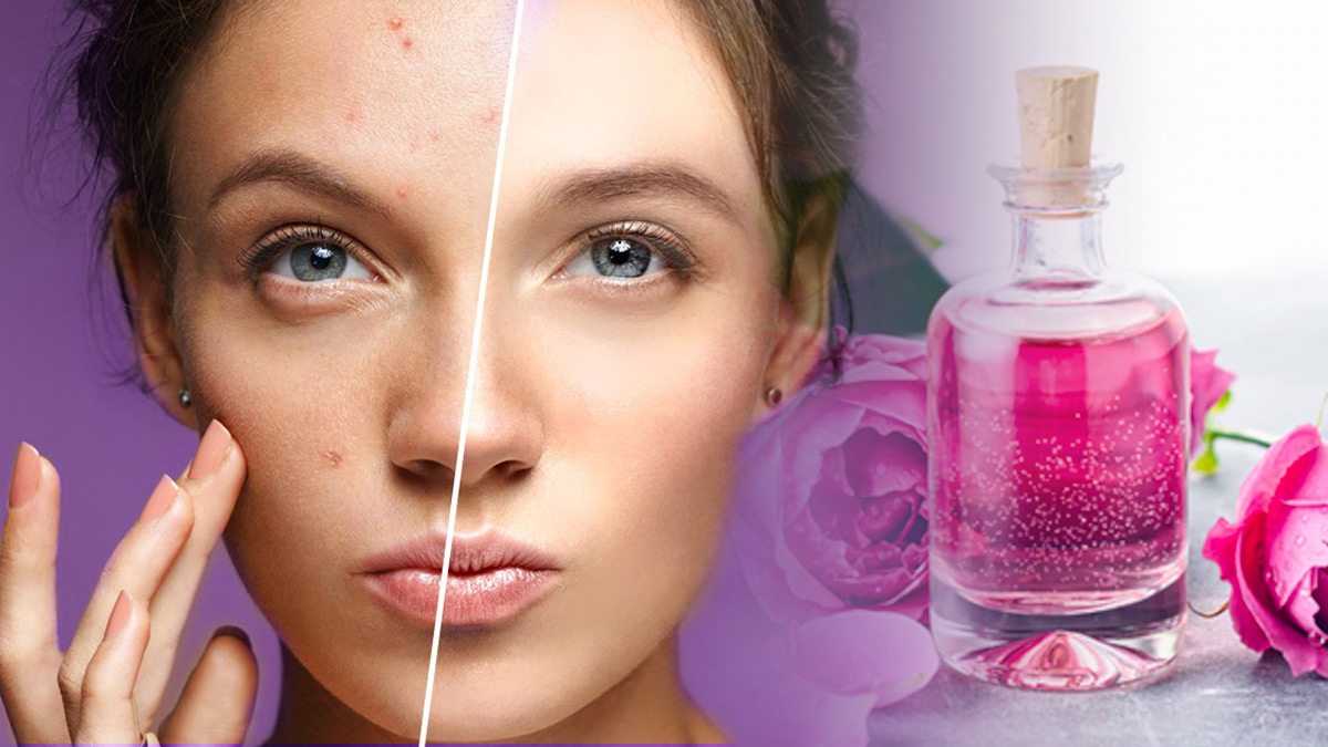 ways you can use rose water to remove acne in telugu ways you can use rose water to remove acne in telugu