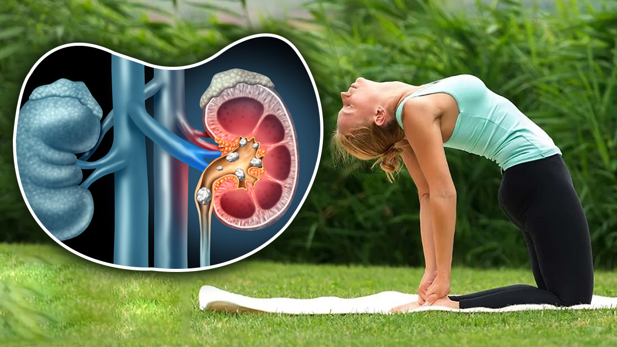 Benefits of Yoga and Exercise for Kidney Stones in telugu Benefits of Yoga and Exercise for Kidney Stones in telugu
