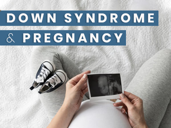 What Is The Reasons For Down Syndrome In Babies 