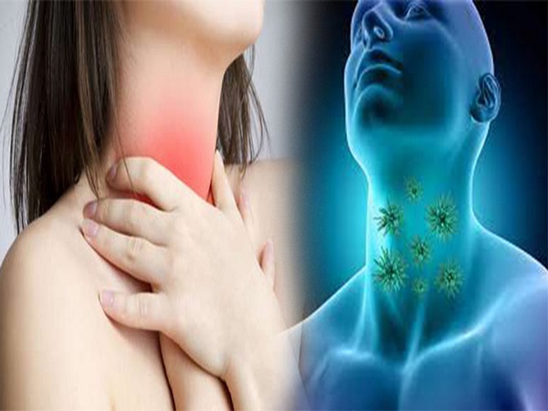 గొంతు ఇన్ఫెక్షన్ కోసం వైద్యుడిని ఎప్పుడు సంప్రదించాలి? గొంతు ఇన్ఫెక్షన్ కోసం వైద్యుడిని ఎప్పుడు సంప్రదించాలి?