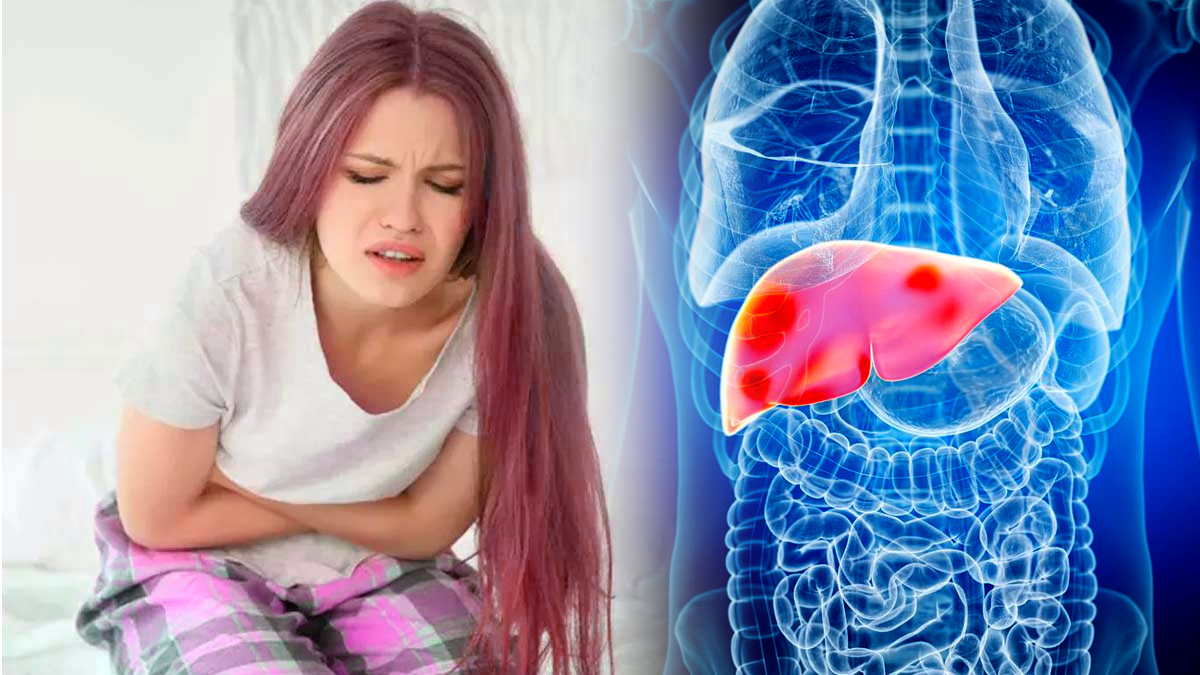 Why even slim people are at risk of fatty liver disease, Know the reasons, diet and lifestyle tips here in telugu Why even slim people are at risk of fatty liver disease, Know the reasons, diet and lifestyle tips here in telugu